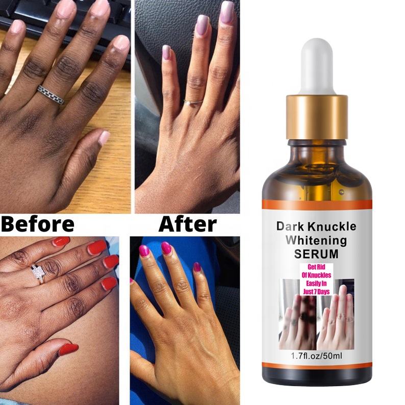 Radiant Glow Dark Spot Corrector™
