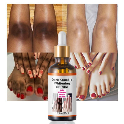 Radiant Glow Dark Spot Corrector™